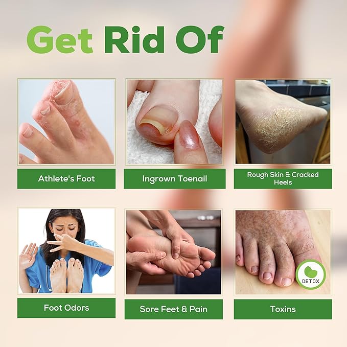 FOOT CURE Tea Tree Oil Foot Soak with Epsom Salt - Best Toenail Fungus Treatment, Athletes Foot & Softens Calluses - Soothes Sore & Tired Feet, Fungal Toe, Foot Odor Scent, Spa Pedicure (Pack of 2) | Tea Tree Oil, with Epsom Salt, Fungal Toe, Foot Odor...